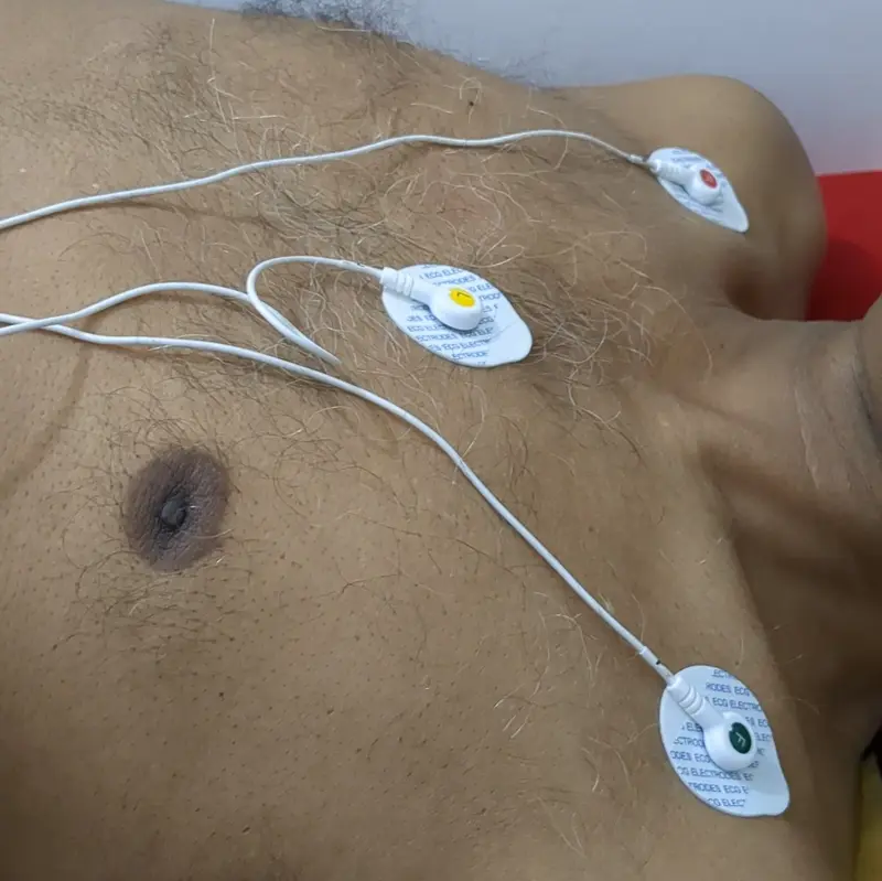 ECG at R C Das Clinic